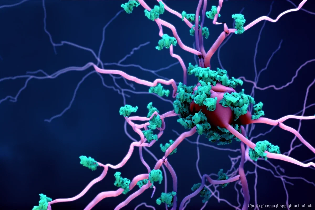 Ученые нашли способ остановить разрушение мозга за 16 лет до первых симптомов
